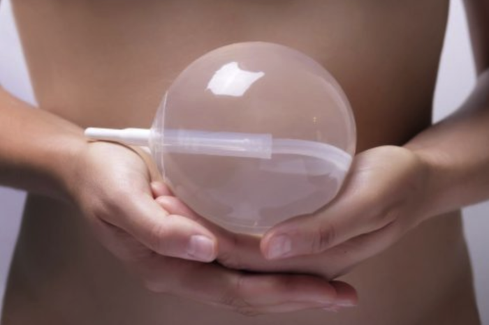 Spatz, balón gástrico sin cirugía